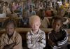 Tanzanie : Une vie de stigmatisation et de violence pour les albinos. Tanzanie : Une vie de stigmatisation et de violence pour les albinos.